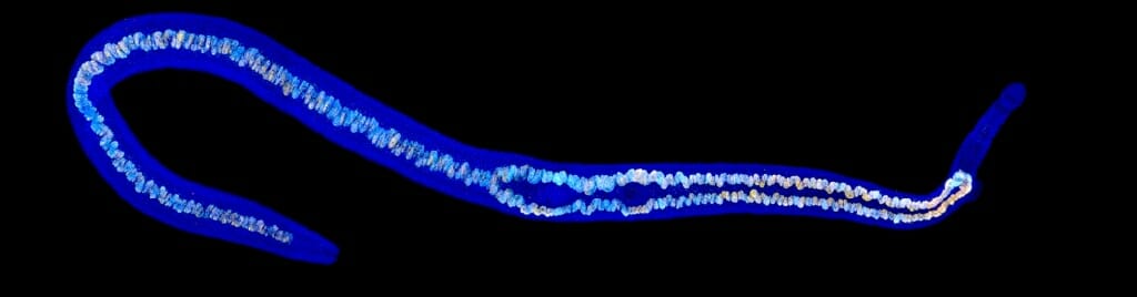 Photo: flatworm Schistosoma mansoni